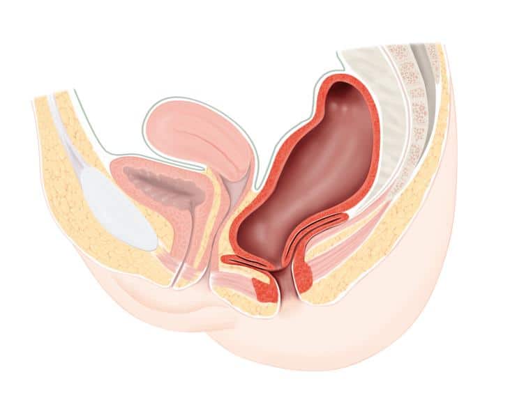 ODS Diagram